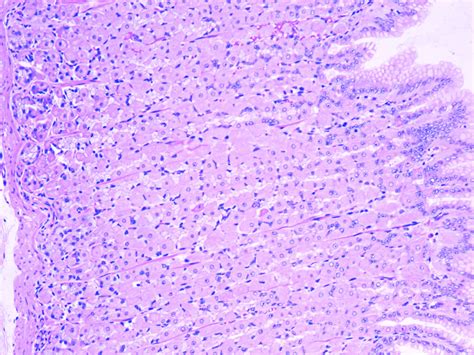 Gastric Gland