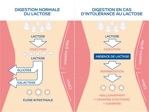 Intol Rance Au Lactose