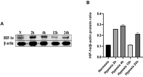 GSH Related Enzyme Activity And Tumor Relation Glutathione Peroxidase