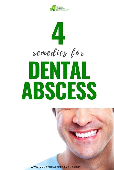 Here You Have The Most Amazing 4 Natural Remedies For Dental Abscess With Simple Herbs And