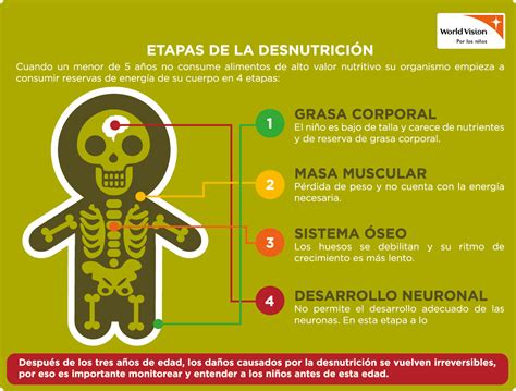 De Ni Os Con Desnutrici N Tienen Problemas Educativos Consultarse