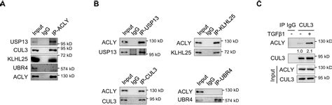 Figures And Data In Acly Ubiquitination By Cul Klhl Induces The