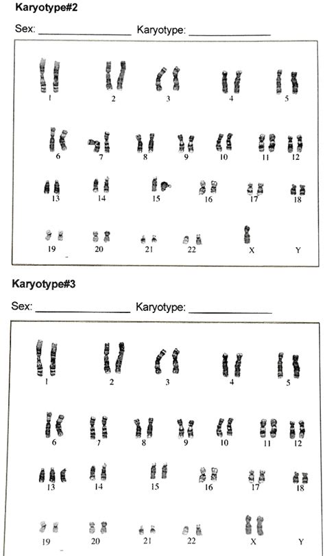 Solved Karyotype2 Sex Karyotype Karyotypen3 Sex Karyotype V 0