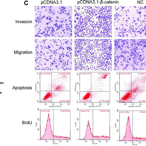 PRDX6 interacted with β catenin and regulated the migration invasion