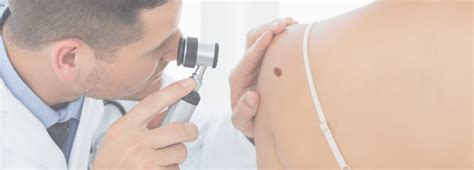 Skin Cancer Screenings Affiliated Dermatology