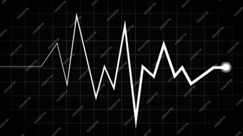 Monitoreo De Ekg De Emergencia Línea De Latido Del Corazón Traza De Pulso Y Gráfico De Ecg