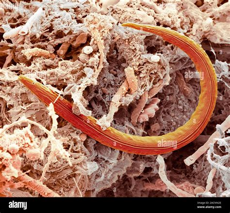 Nematode Worm Coloured Scanning Electron Micrograph Sem Of A Freshwater Nematode From A Pond