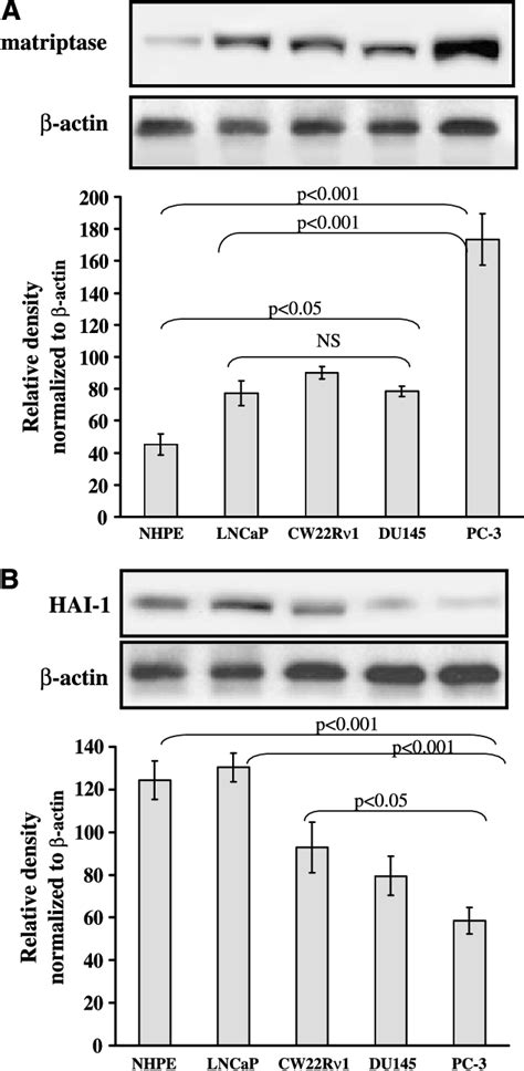 Figure 1 From A Novel Biomarker For Staging Human Prostate