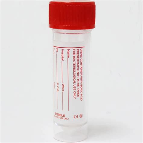 Urine Container With Boric Acid Niche Healthcare