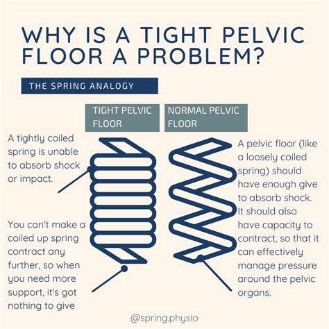 Hypertonic Pelvic Floor Visual