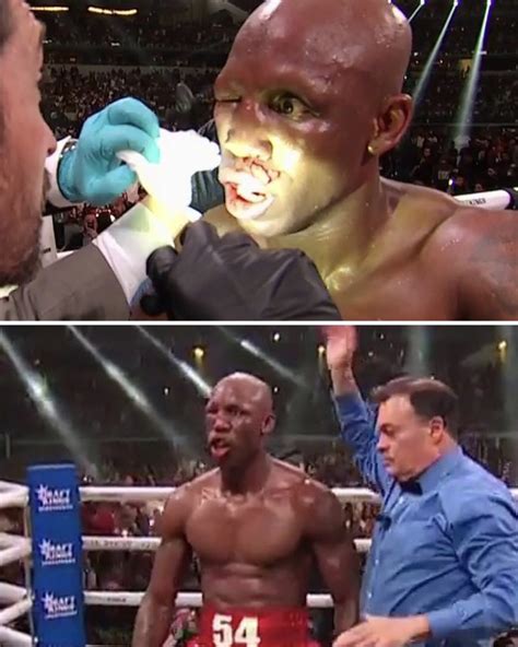 ESPN Ringside On Twitter Yordenis Ugas Eye Was Swollen Shut By The