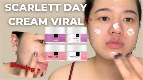 Review Jujur Scarlett Bright Acne Day Night Cream Pakai Minggu