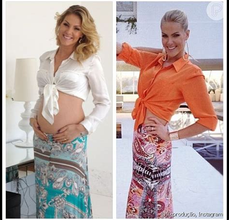 Ana Hickmann Compara Barriga De Meses De Gravidez Fotos De Antes