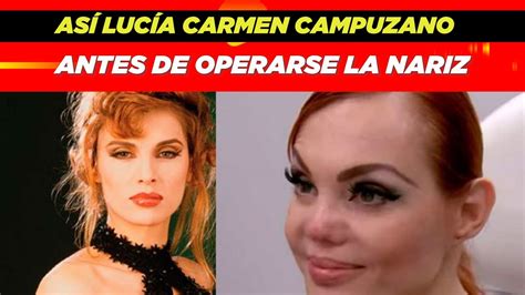 As Luc A Carmen Campuzano Antes De Operarse La Nariz Youtube