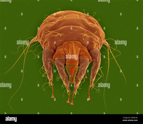 Coloured Scanning Electron Micrograph Sem Of Sheep Scab Mite