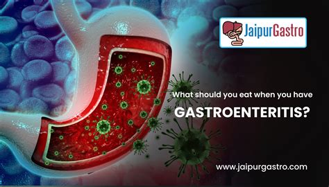 What to Eat in Gastroenteritis in 2022? | Diet in Gastroenteritis