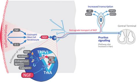 Topical Trka Kinase Inhibitor Ct Is An Effective Novel Therapy For