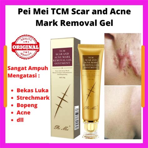 Jual Acne Pei Mei TCM Scar And Acne Mark Removal Gel Ointment Original