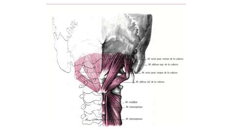 Solution Musculos Cuello Y Cabeza Studypool