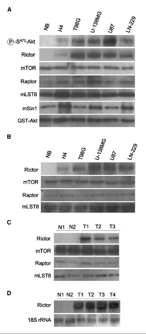 Figure 1 From MTORC2 Activity Is Elevated In Gliomas And Promotes