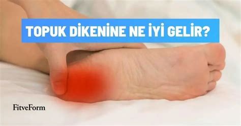 Topuk Dikeni Nedir Topuk Dikenine Ne Yi Gelir Fit Ve Form