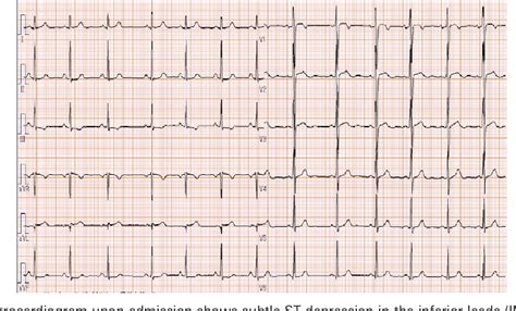 Figure 1 From Case Of A 16 Year Old Girl Diagnosed With Microvascular