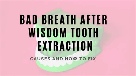 How Many Wisdom Teeth Do People Have Teeth Faq Blog