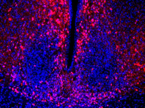 Addgene Aav Data Hub Paav Hsyn Dio Mcherry In Mouse Aav