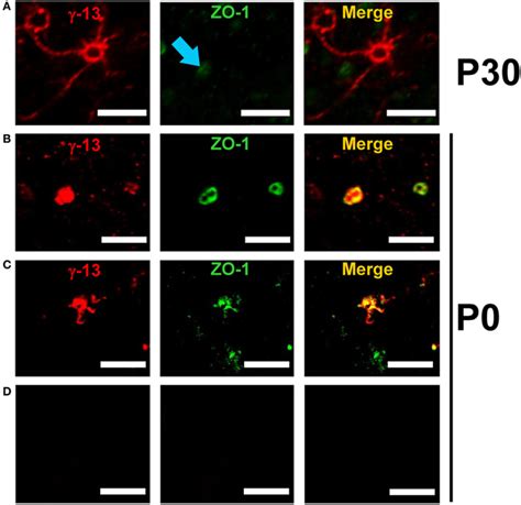 Co Localization Of Zo 1 And Gγ13 In Mouse Olfactory Sensory Neurons Is