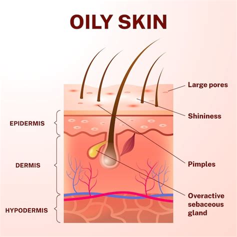 Layers Of Skin Diagram