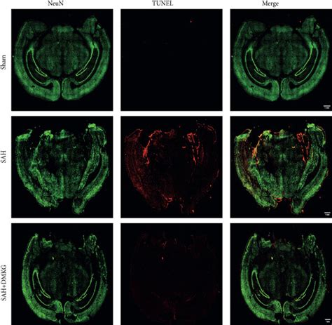 α KG alleviated neuronal apoptosis after SAH in mice a b The TUNEL