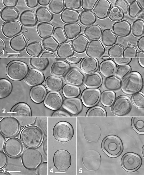 5 Primary And Secondary Sporangia In Various Albuginaceae 1 Primary