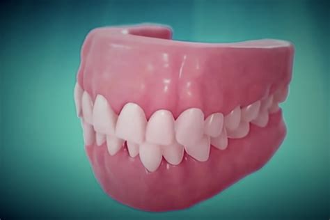 Fixing Crowded Misaligned And Crooked Teeth With Orthodontics