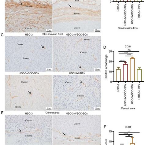 Effects Of Vscc Scs Scc Scs And Hdfs On The Migration Of Macrophages