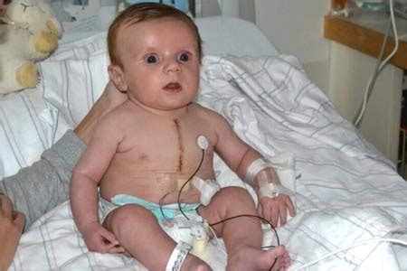 Pediatric Cardiac Surgery in India: Causes, Procedure, Hospitals