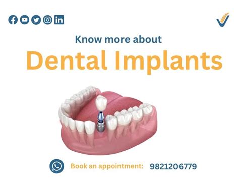 Understanding Dental Implants A Simple Guide V Medica Multi