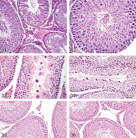 Rat Testis Depletion Germ Cells Spermatogonia Spermatocytes Download Scientific Diagram