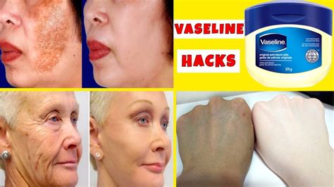 Top 3 Magical Beauty Hacks Using Vaseline Every Girl Must Know Vaseline Hacks Youtube