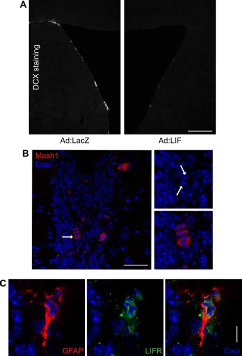 LIF Reduces Neuronal Differentiation In The SVZ And LIFR Is Expressed