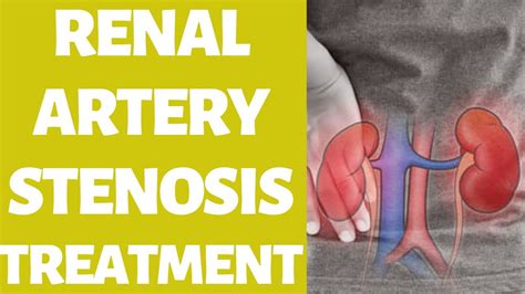 How To Treat Renal Artery Stenosis Beat Kidney Disease Easily At Home