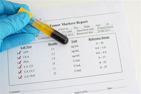 Normal Ast Alt Range High Low And Normal Results Symptoms And Causes