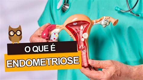 O Que Endometriose Saiba Como Surge Se Tem Cura E Se Causa