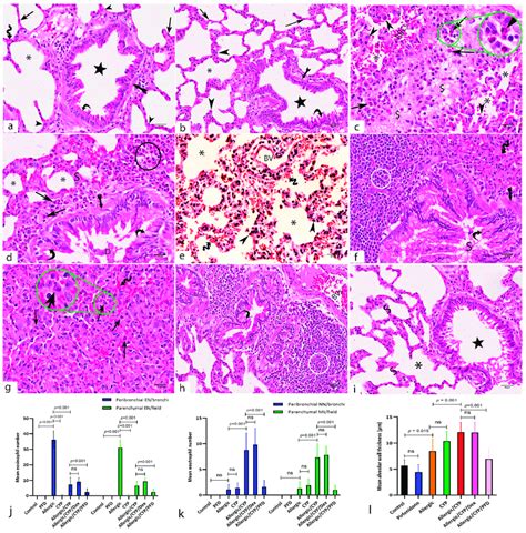 Photomicrographs Of Hande Stained Lung Sections Of The Study Groups