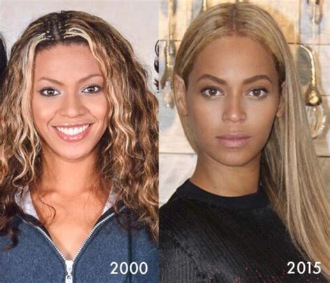 Has Beyoncé Had Cosmetic Surgery