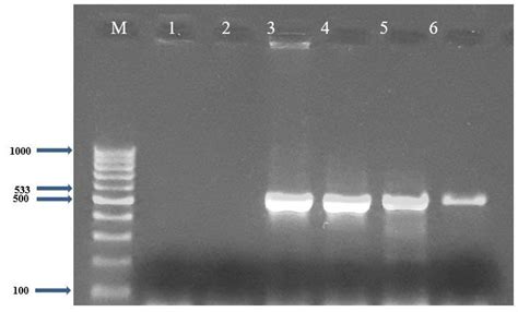 2 Of Agarose Gel Electrophoresis Shows The Product Size Of The Nuc