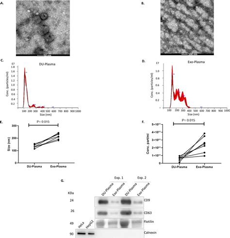 Characterization Of Evs Isolated From Human Plasma A Tem Image Of