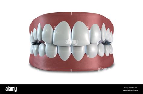 Seperated upper and lower sets of human teeth set in gums on an ...