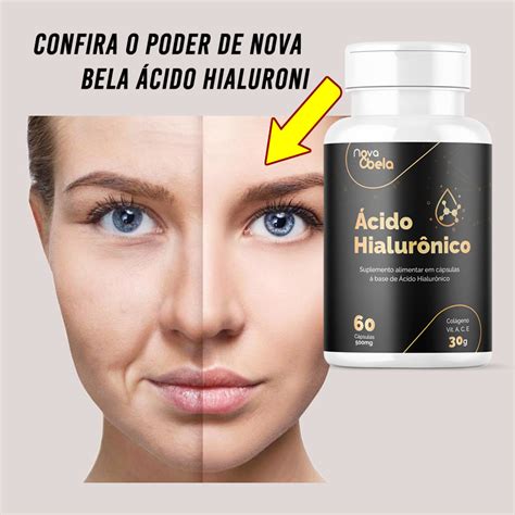 Ácido Hialurônico Com Colágeno Hidrolisado E Vitaminas Ac E E Terra