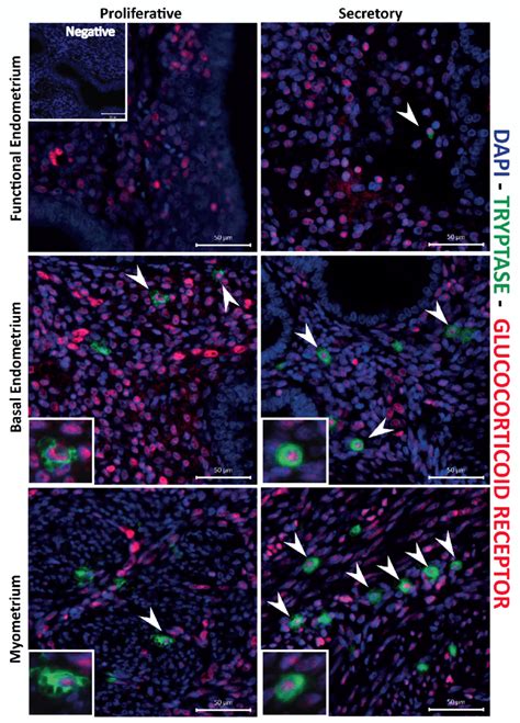 Uterine Mast Cells In The Endometrium And Myometrium Are Immunopositive