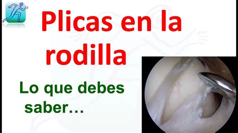 Plicas Y Pinzamientos Sinoviales En La Rodilla Lo Que Debes Saber